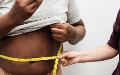 Could Hormones Affect Your Weight Loss Journey?